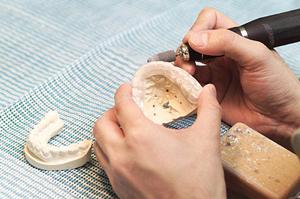 インプラント治療が評判の群馬の歯科医院