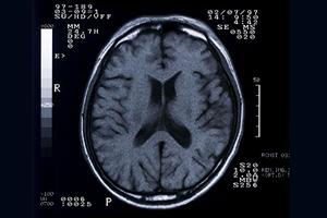 末期の胃がんでもあきらめないでください