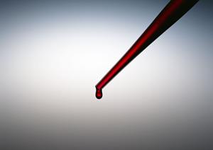 平尾の歯科で矯正を自分の都合で行える